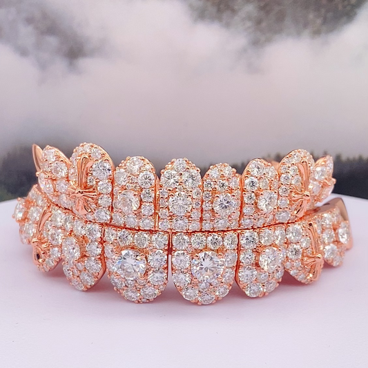 Luxury Rose Gold Moissanite Grillz – Full Diamond-Set Double Row Dental Grillz