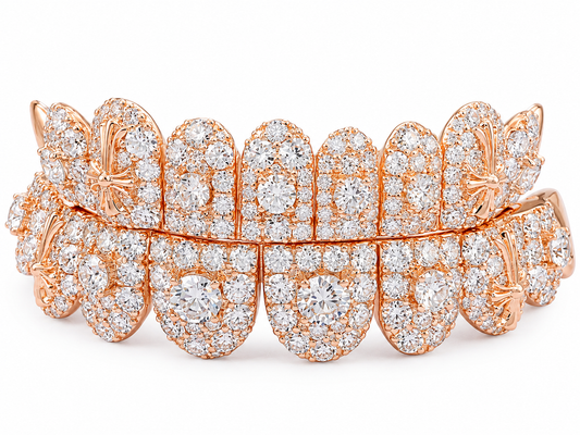 Luxury Rose Gold Moissanite Grillz – Full Diamond-Set Double Row Dental Grillz