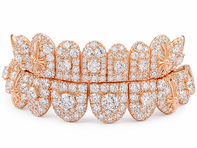 Luxury Rose Gold Moissanite Grillz – Full Diamond-Set Double Row Dental Grillz