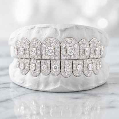 Star Crown Pavé Moissanite Grillz